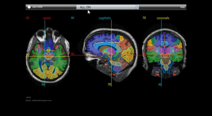 Brain MRI Anatomy Module Tutorial - touchNEUROLOGY