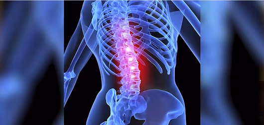 Minimally Invasive Non Fusion Surgery: Dr. David Kosmoski