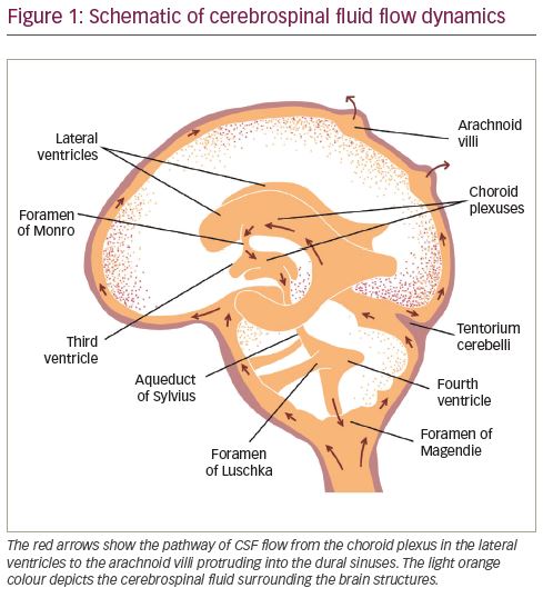 Lumbar Puncture: Indications, Challenges and Recent Advances