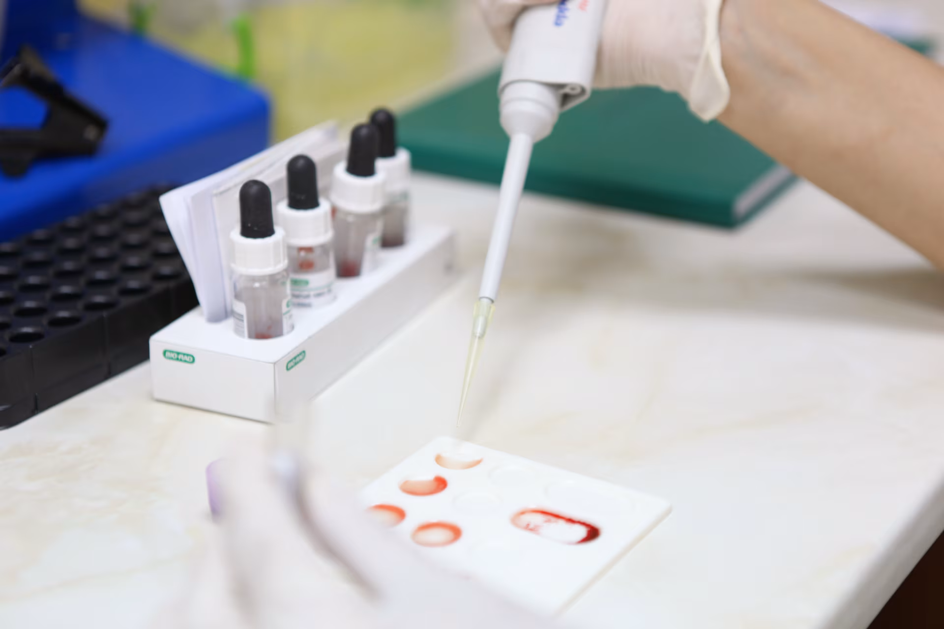 blood test