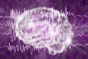 epilepsy